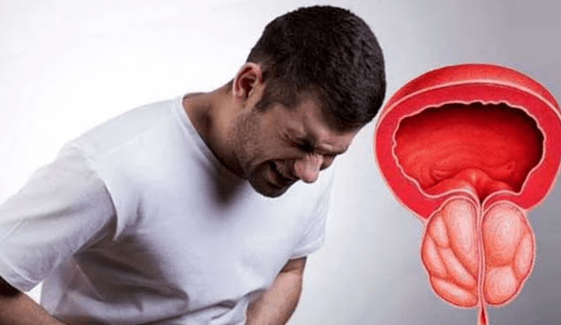 Symptoms and treatments