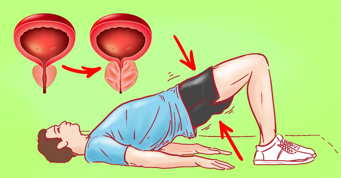 Gymnastics to treat prostatitis